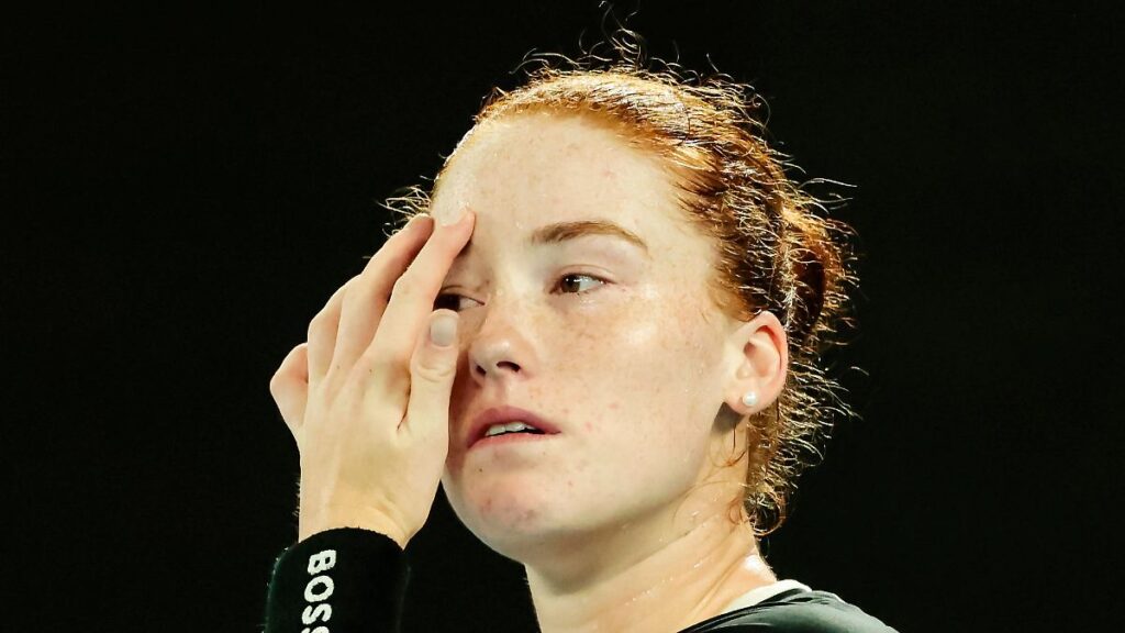 sabalenka lippen